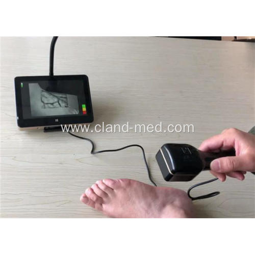 Tablet Medical Infrared Vein Finder With Touch Screen